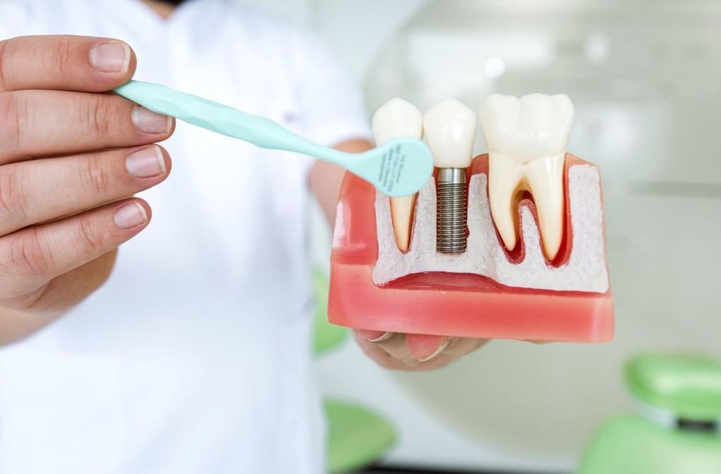 cobertura dental Sanitas